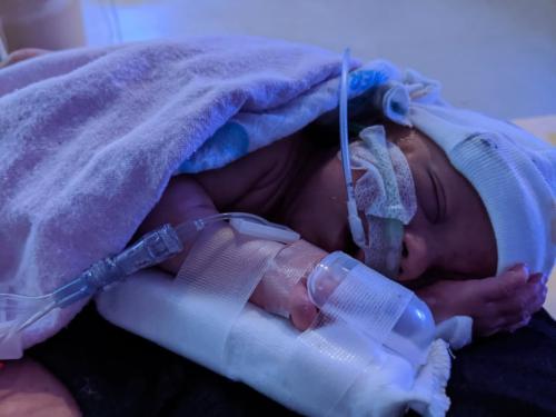 EMILKA-po-operacji-spi