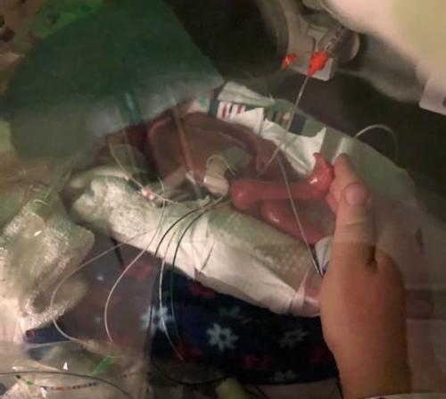 EMILKI-MALENKA-NOZKA